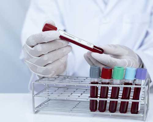 全国有哪些医院供卵医院,孕期为什么会出现漏尿情况，如何避免孕期漏尿