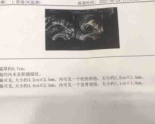 国内哪有代怀公司,人工授精后当天有褐色,人工授精后当天轻微出血