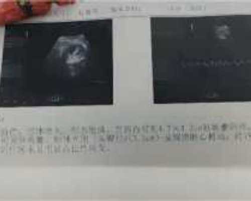 国内寻找供卵女孩,辽宁试管医院：试管移植后多久胚胎可以着床