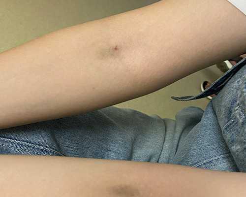 国内代怀孕套餐,柬埔寨做试管要准备什么资料，赴柬埔寨做试管所需证件资料及注意事项